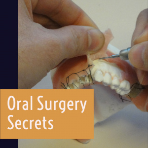 Oral Surgery Secrets
