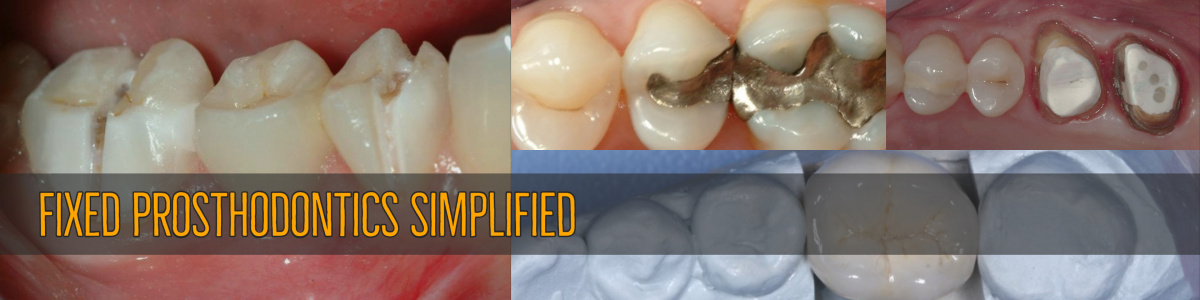 Fixed Prosthodontics