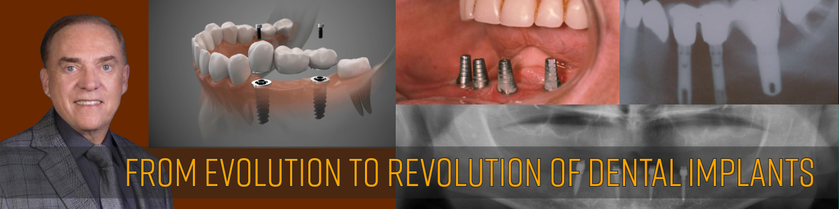 Implant Revolution