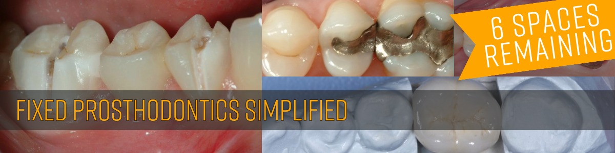 Fixed Prosthodontics