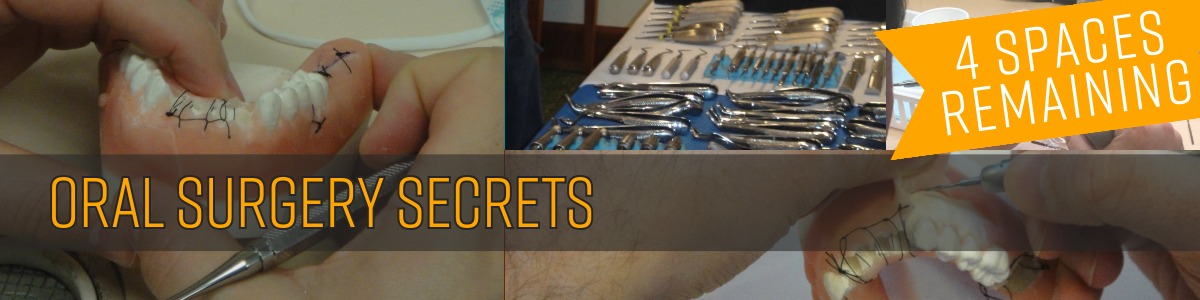 Oral Surgery Secrets