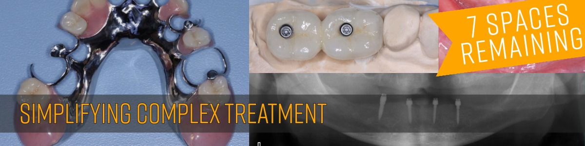 Simplifying Complex Treatment