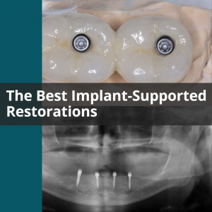The Best Implant-Supported Restorations - V2333 - CE Video Library