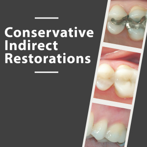 Conservative Indirect Restorations - X1946 - Prosthodontics, Fixed - CE Video Library