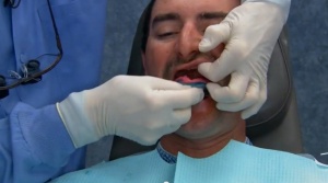 Making Complete Dentures a “Win-Win” Service - V2549