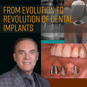 From Evolution to Revolution of Dental Implants