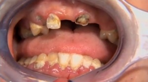 Oral Surgery in General Practice - V4116 - CE Video Library