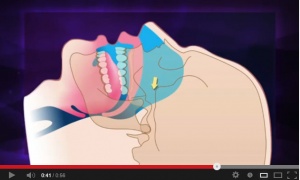 Snoring and Sleep Apnea – Prevention and Treatment - V3963 - Oral Medicine - CE Video Library
