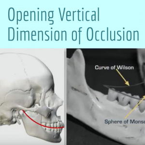 Opening Vertical Dimension of Occlusion - V3186 - Occlusion - CE Video Library