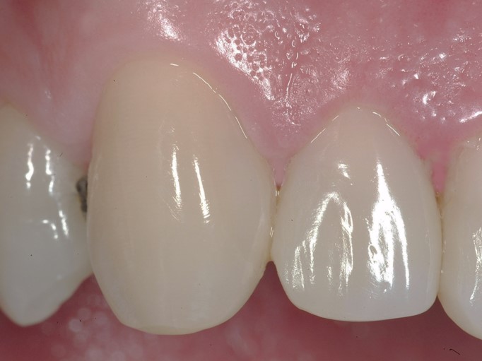 Esthetic Dentistry Package Esth2018