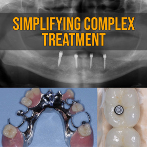 Simplifying Complex Treatment